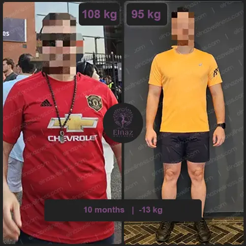 before and after