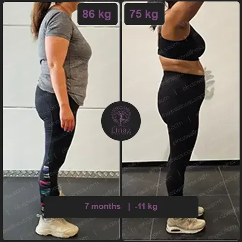 before and after
