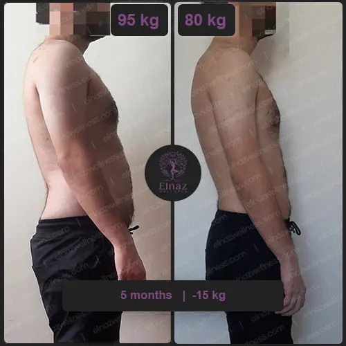 before and after