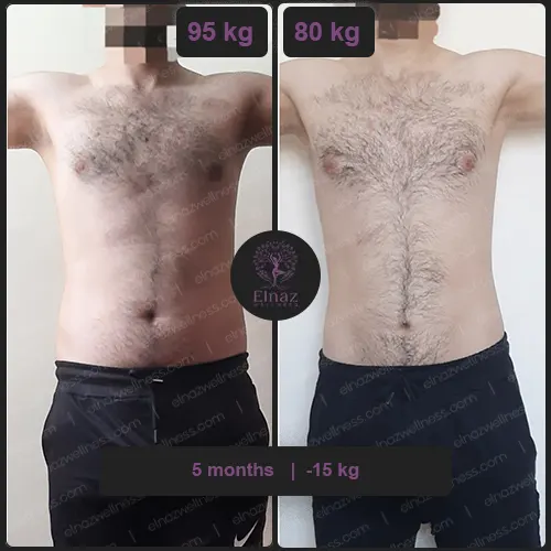 before and after